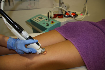 Tratamiento para varices