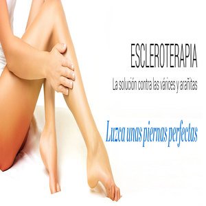 Tratamiento para varices